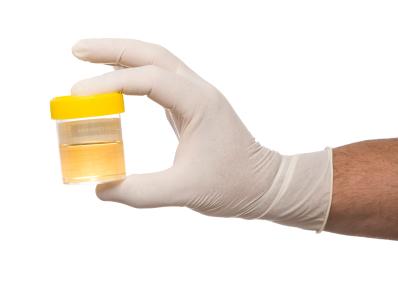 how to hide urine for a supervised drug test