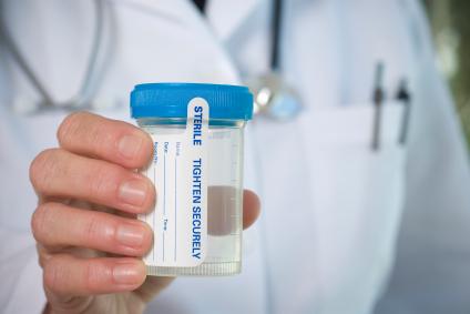 how to hide urine for a supervised drug test